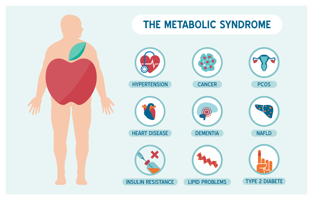 metabolic syndrome and poor metabolic health deseases